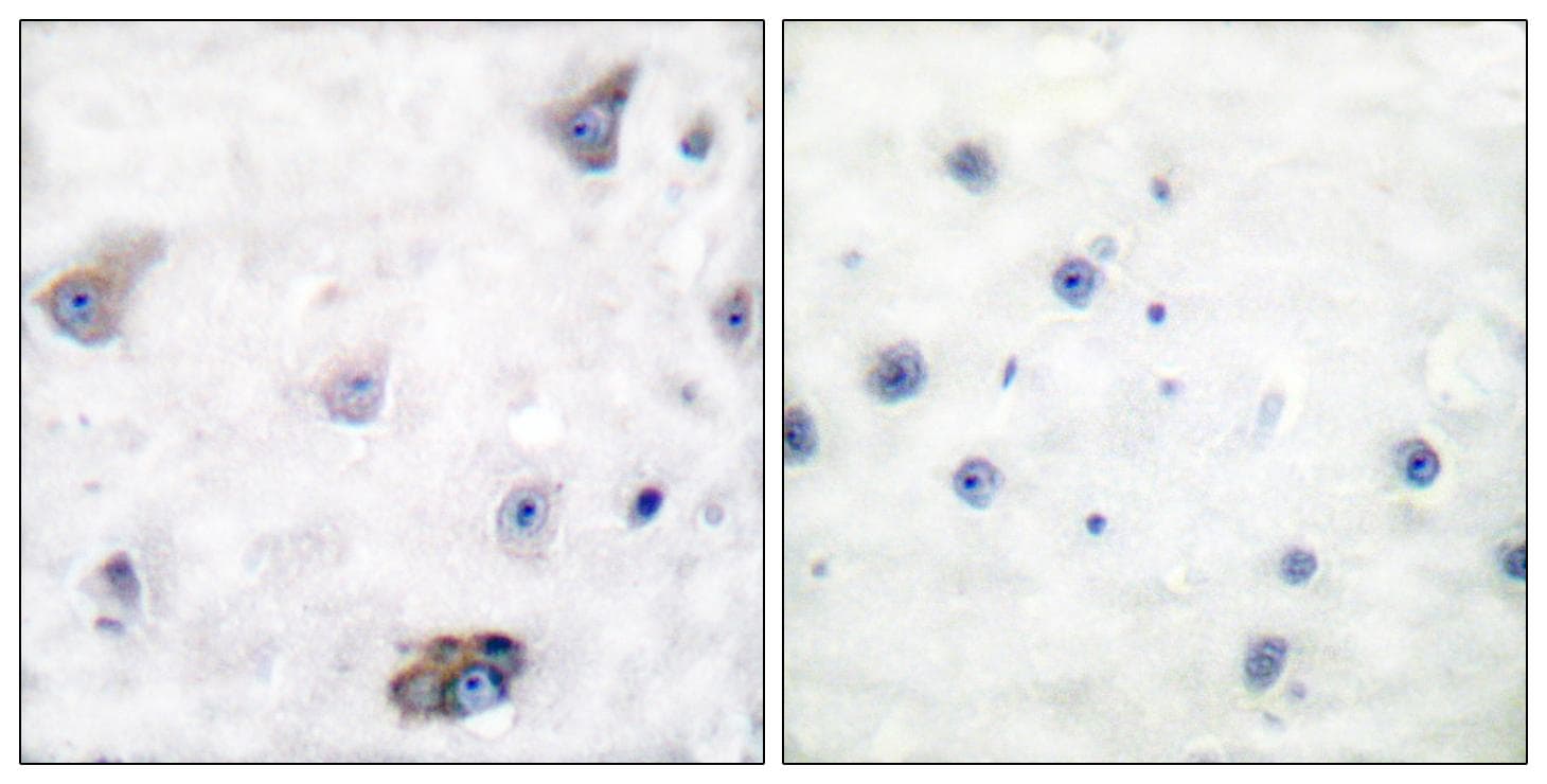 GABRB1 Antibody (phospho-Ser434)