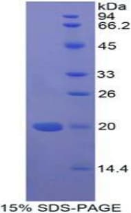 Human MFAP5 / MAGP2 Protein (Recombinant His-T7)