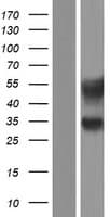 Equatorin / AFAF Protein (Over-Expression Lysate Myc-DDK (Flag))
