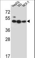 Polyclonal Rabbit anti-Human LIPJ Antibody (aa186-215, WB)