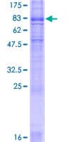 Human SLC6A4 / SERT Protein (Recombinant GST)