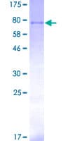 Human STK11 / LKB1 Protein (Recombinant GST)
