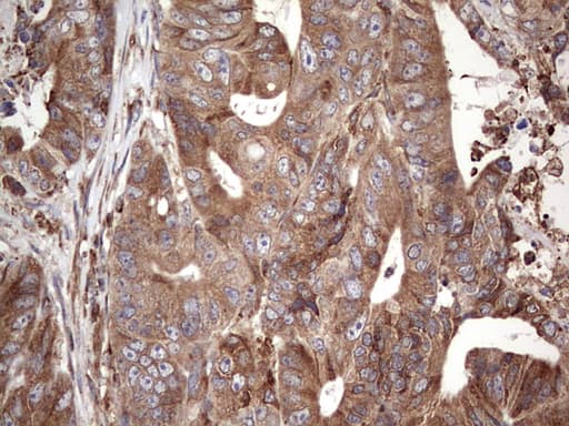 BFSP1 / Filensin Antibody (aa405-665, clone OTI3H6)