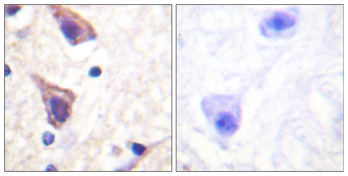 TGFBR2 Antibody (aa191-240)