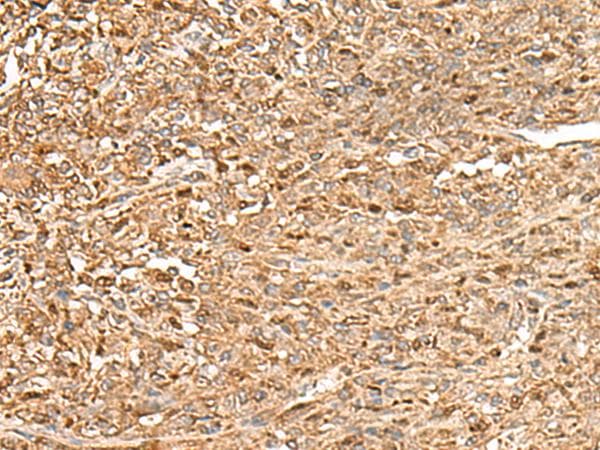 ZC3H7A Antibody
