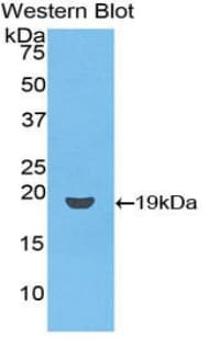 Polyclonal Rabbit anti-Human CD59 Antibody (aa26-102, WB)