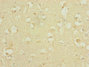 DHTKD1 Antibody