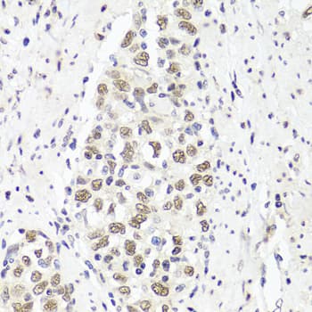 PARP1 Antibody