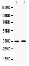 HSD17B6 Antibody (aa300-317)