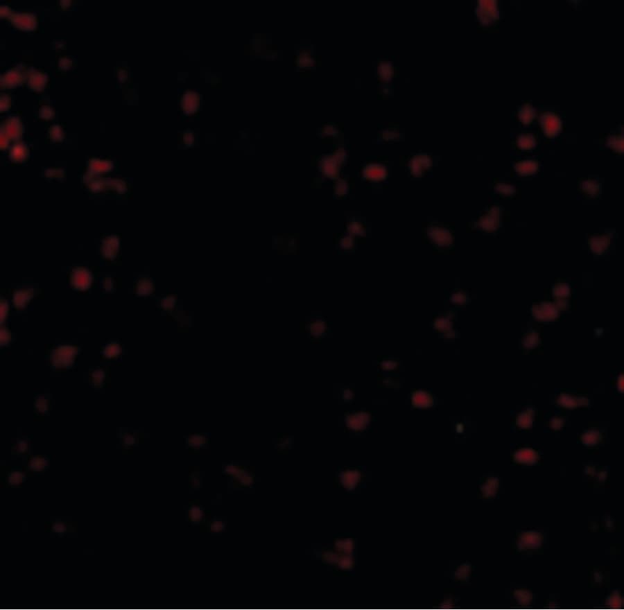 IHC-plus™ Polyclonal Rabbit anti-Human BUB1 Antibody (IHC, IF, WB)