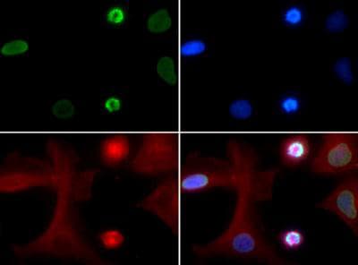 HIST4H4 Antibody (Ac-Lys5)