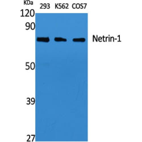 NTN1 / Netrin 1 Antibody (C-terminal)