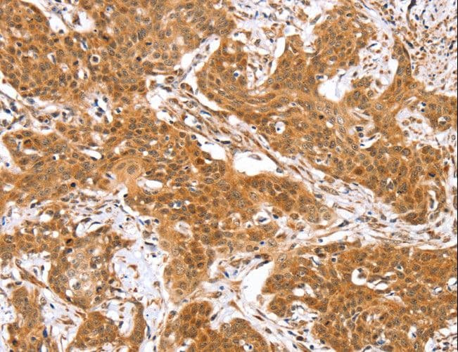 Polyclonal Rabbit anti-Human RGS22 Antibody (IHC, WB)