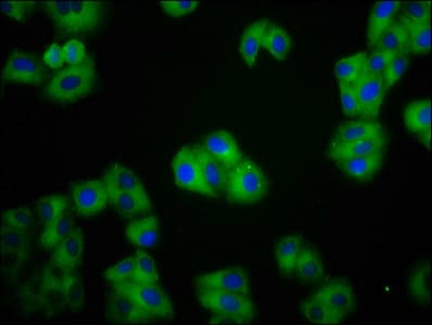 IHC-plus™ Polyclonal Rabbit anti-Human CDH1 / E Cadherin Antibody (IHC, IF, WB)