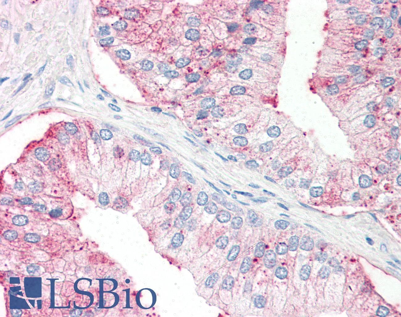 IHC-plus™ Polyclonal Rabbit anti-Human SLC39A14 / ZIP14 Antibody (Internal, IHC)