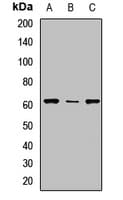 Polyclonal Rabbit anti-Human UGT2B10 Antibody (IHC, WB)