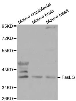FASLG / Fas Ligand Antibody