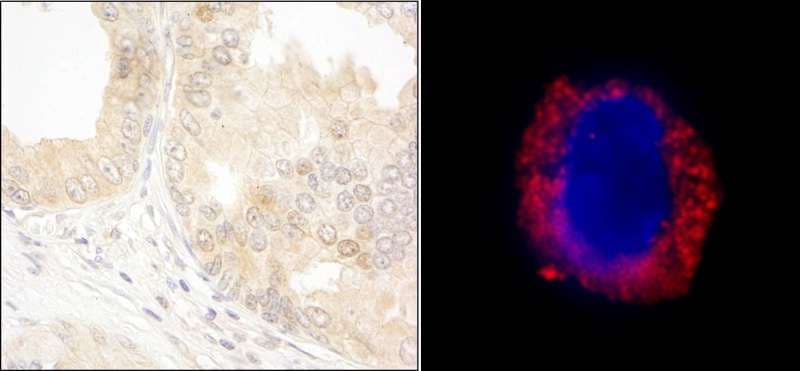 ABL1 / c-ABL Antibody (aa550-600)