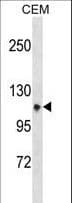ITGA7 / Integrin Alpha 7 Antibody (aa229-257)