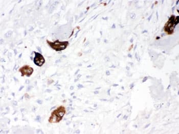 CTSK / Cathepsin K Antibody