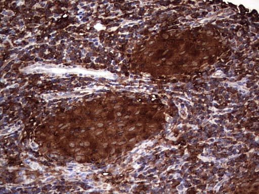 PKM2 Antibody (clone 1G10)