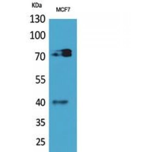 CD110 / MPL Antibody (321-370 aa, Internal)