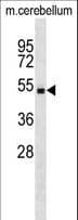 STK4 Antibody (aa443-470)