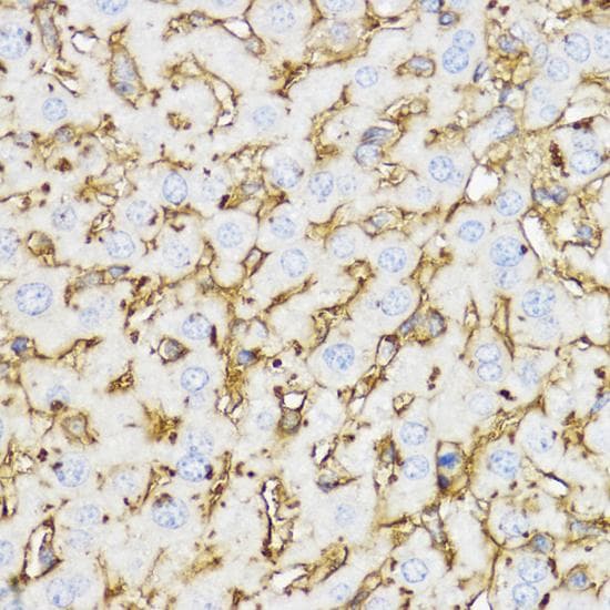 Polyclonal Rabbit anti-Human CHI3L1 / YKL-40 Antibody (IHC, IF)