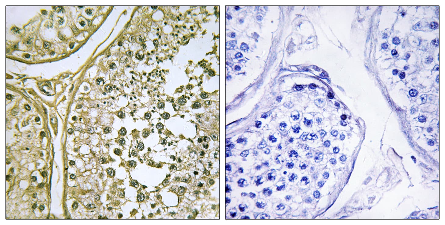 CSNK1A1 + CSNK1A1L Antibody (Internal)