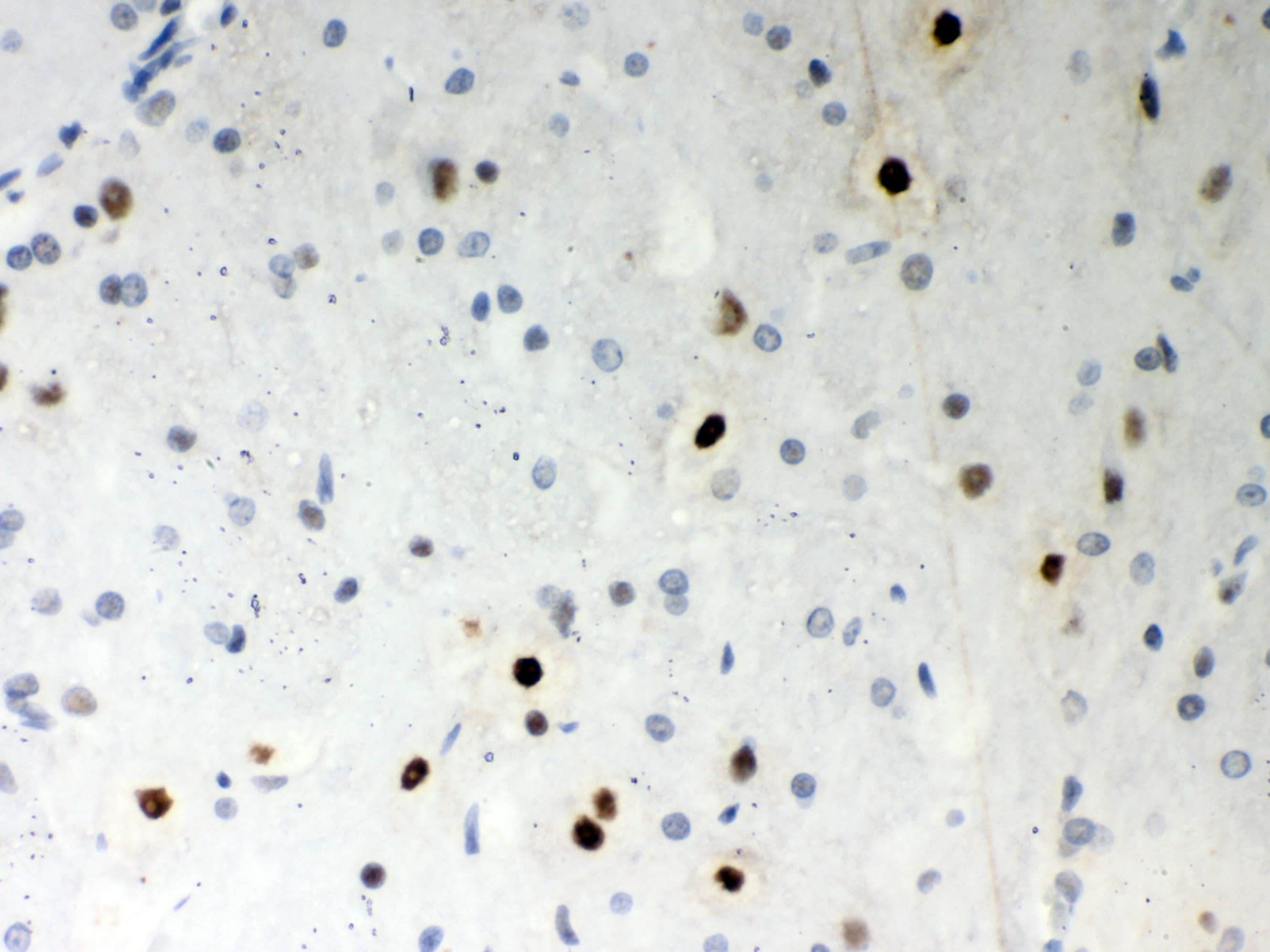 SRSF1 / SF2 Antibody (aa6-33)