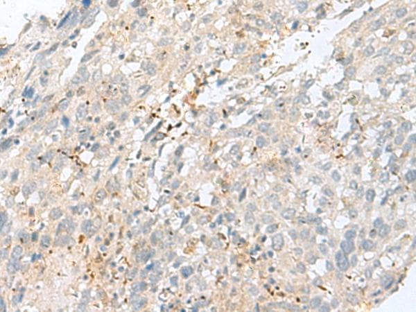 TPMT Antibody