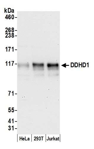 Polyclonal Rabbit anti-Human DDHD1 Antibody (aa50-100, WB)