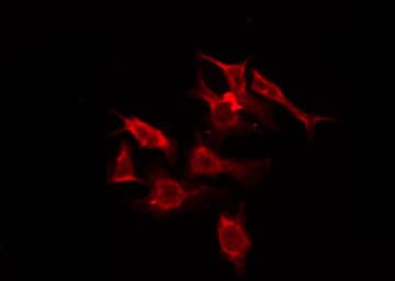 OR5M11 Antibody