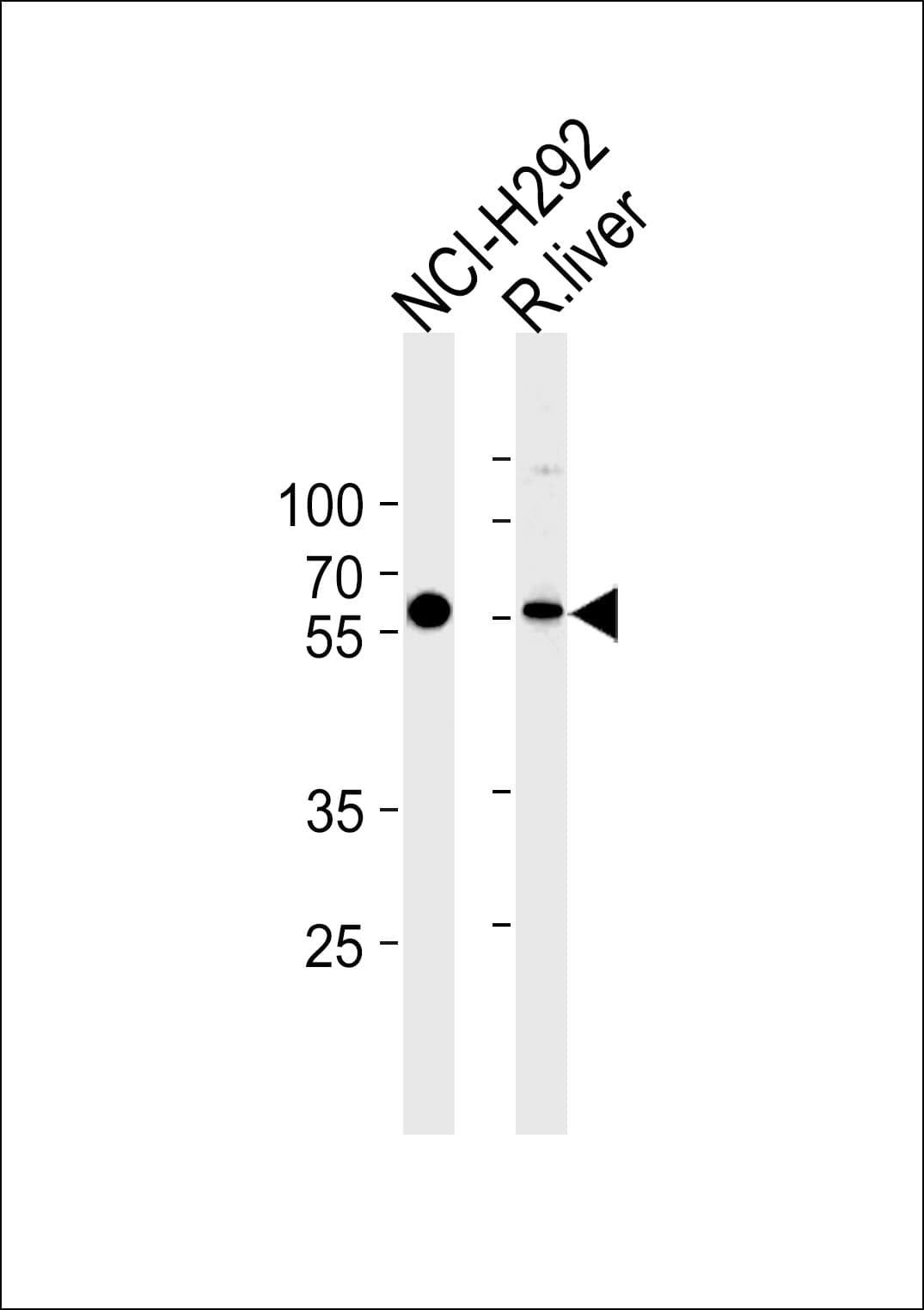 MCCC2 / MCCB Antibody (aa163-189)