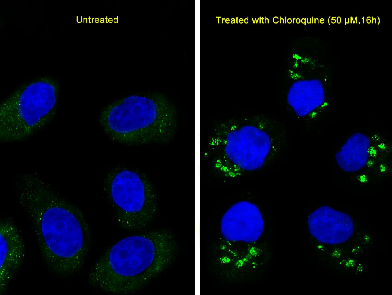 MAP1LC3A / LC3A Antibody