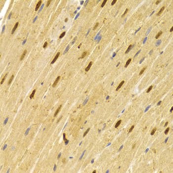 CDC25A Antibody
