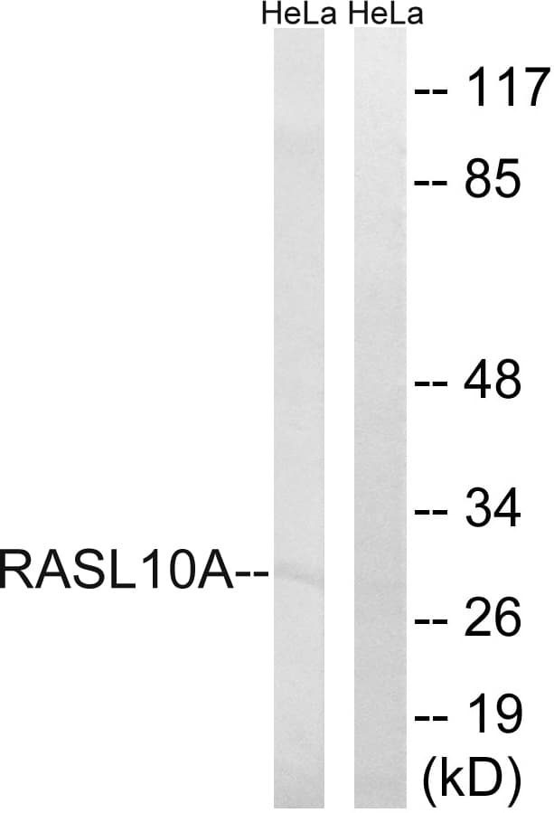 Polyclonal Rabbit anti-Human RRP22 / RASL10A Antibody (aa107-156, WB)