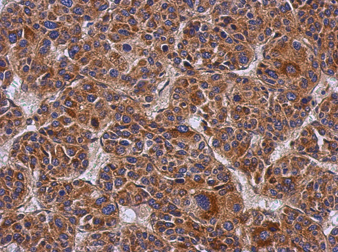 CCDC50 Antibody