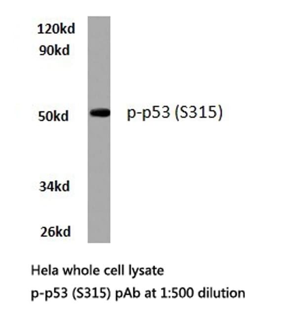 Polyclonal Rabbit anti-Human TP53 / p53 Antibody (phospho-Ser315, IHC, WB)