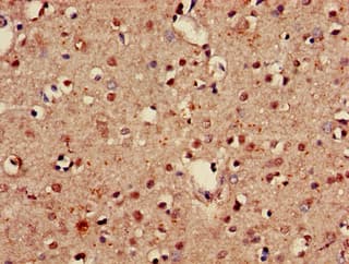 Polyclonal Rabbit anti-Human GABARAPL1 / ATG8 Antibody (IHC, IF)