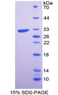 Human FACT / SSRP1 Protein (Recombinant His-T7)