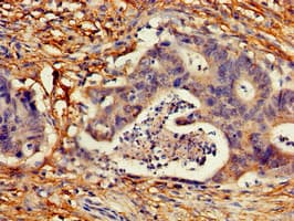 CDKN2C / p18 INK4c Antibody
