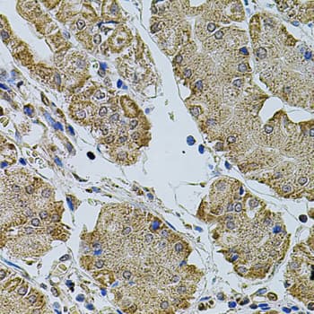 CREBBP / CREB Binding Protein Antibody