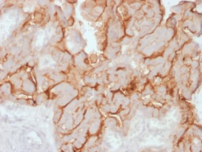 Recombinant Monoclonal Rabbit anti-Human CA125 Antibody (clone OCA125/2349R, Azide-free,Carrier-free, IHC)