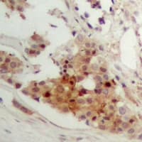 NR1I3 / CAR Antibody (Internal)