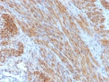 DES / Desmin Antibody (clone DES/1711, Azide-free, BSA-free)