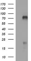 Monoclonal Mouse anti-Human MAdCAM-1 Antibody (clone OTI1E5, WB)