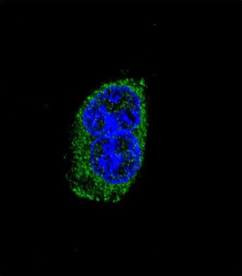 TSHB / TSH-Beta Antibody (aa58-86)
