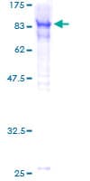 Human TOX Protein (Recombinant GST)