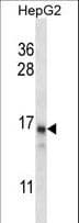 DDA1 Antibody (aa11-40)